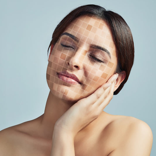 Natural remedies and best ingredients for uneven skin tone, blemishes and melasma